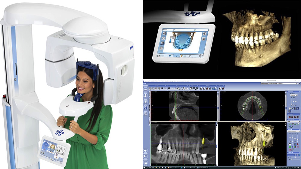 scanner 3D dentaire Moirans