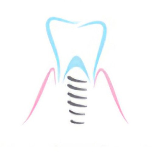 implants dentaires Moirans