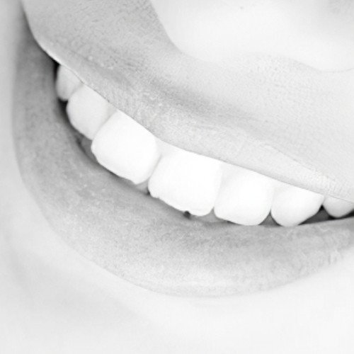 soins dentaires Moirans Esthetique dentaire Moirans